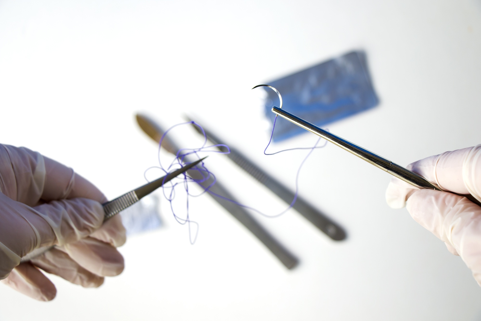 fil résorbable en chirurgie